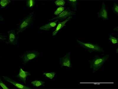 Immunocytochemistry/ Immunofluorescence: mpp8 Antibody [H00054737-B01P]