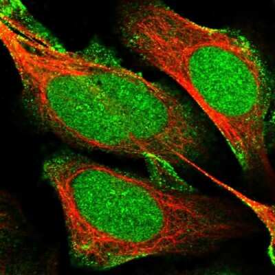 Immunocytochemistry/ Immunofluorescence: mpp8 Antibody [NBP1-92135]