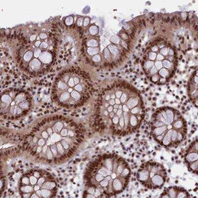 Immunohistochemistry-Paraffin: mpp8 Antibody [NBP1-92136]