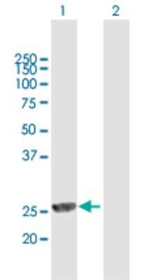 Western Blot: mpp8 Antibody [H00054737-B01P]