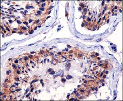 Immunohistochemistry-Paraffin: mtTFA Antibody (18G102B2E11) [NBP1-71648]