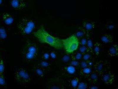 Immunocytochemistry/ Immunofluorescence: mu Crystallin Antibody (OTI1G7) [NBP2-02829]