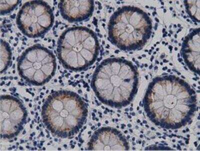 Immunohistochemistry-Paraffin: mu Crystallin Antibody (OTI1G7) [NBP2-02829]