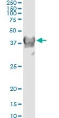 Immunoprecipitation: mu Crystallin Antibody (6B3) [H00001428-M03]