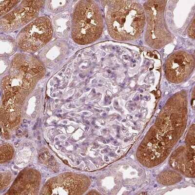 Immunohistochemistry-Paraffin: mu Crystallin Antibody [NBP2-55172]