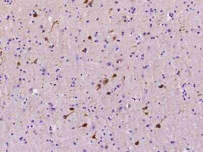 Immunohistochemistry-Paraffin: mu Crystallin Antibody [NBP2-99358]