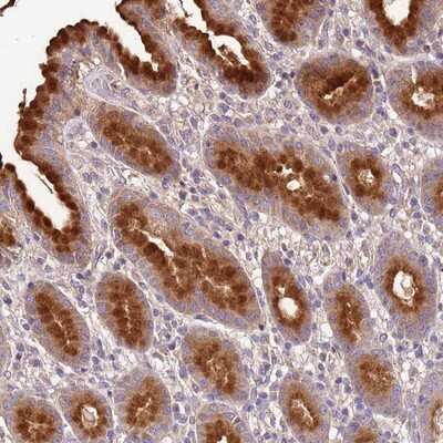 Immunohistochemistry-Paraffin: mut-7 Antibody [NBP1-92155]