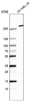 Western Blot: myosin X Antibody (CL9025) [NBP2-88927]