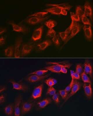 Immunocytochemistry/ Immunofluorescence: myosin X Antibody - BSA Free [NBP2-94085]
