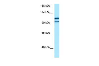 Western Blot: myosin X Antibody [NBP2-85352]