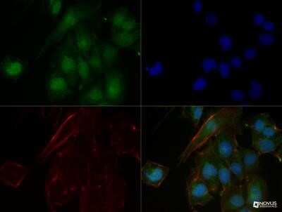 Immunocytochemistry/ Immunofluorescence: n-Myc Antibody (NMYC-1) - Azide and BSA Free [NBP2-80882]