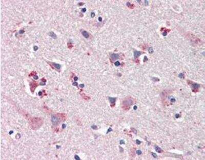 Immunohistochemistry-Paraffin: nNOS Antibody [NBP1-97555]