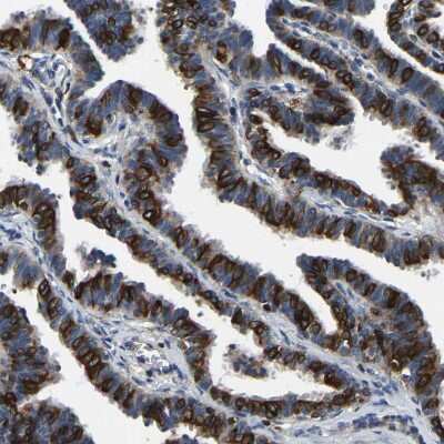 Immunohistochemistry-Paraffin: nSMase Antibody [NBP1-87810]