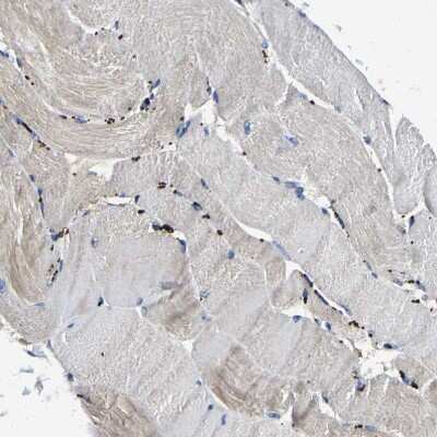 Immunohistochemistry-Paraffin: nSMase Antibody [NBP1-87810]