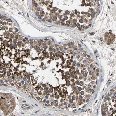 Immunohistochemistry-Paraffin: nSMase Antibody [NBP1-87810]