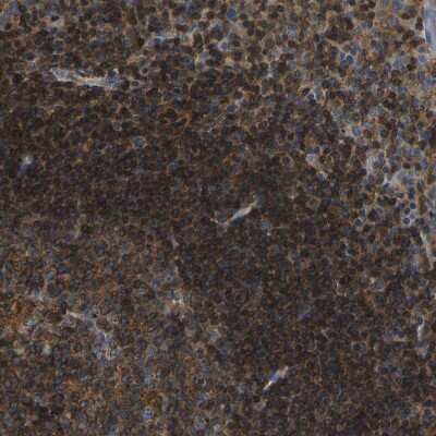 Immunohistochemistry-Paraffin: nSMase Antibody [NBP1-87810]