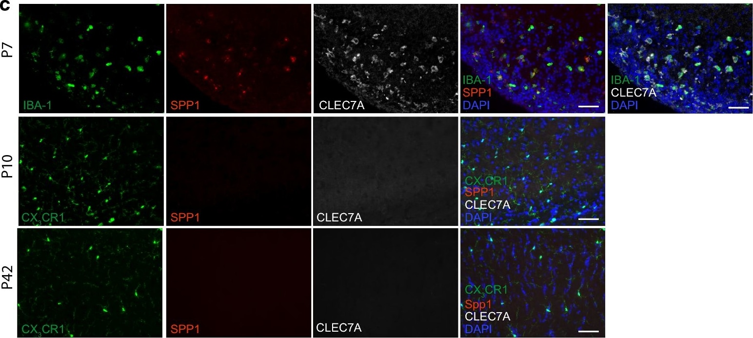 AIF-1/Iba1 Antibody