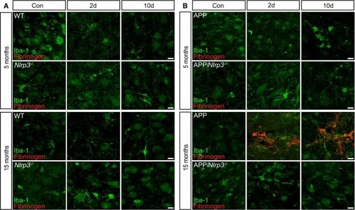 AIF-1/Iba1 Antibody