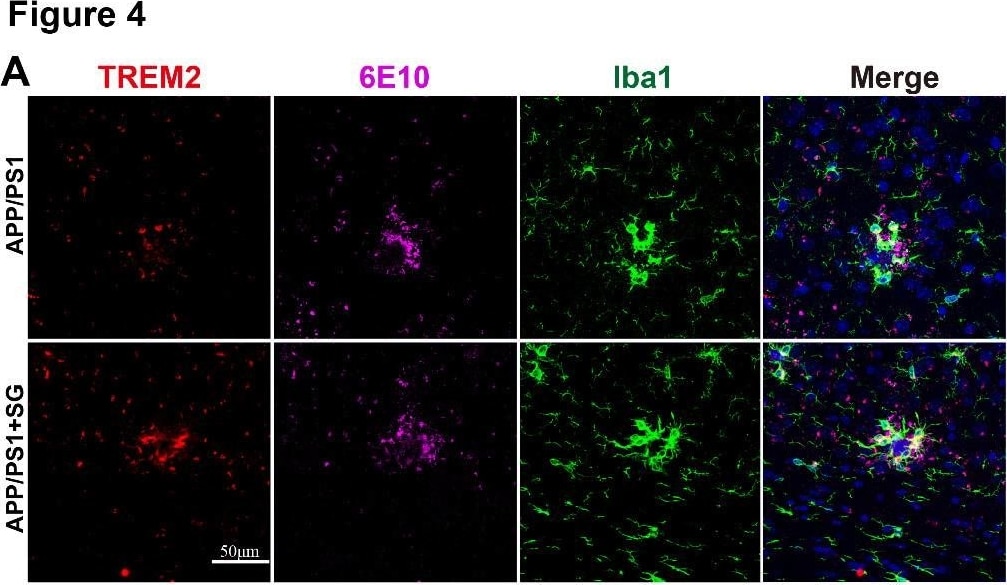 AIF-1/Iba1 Antibody