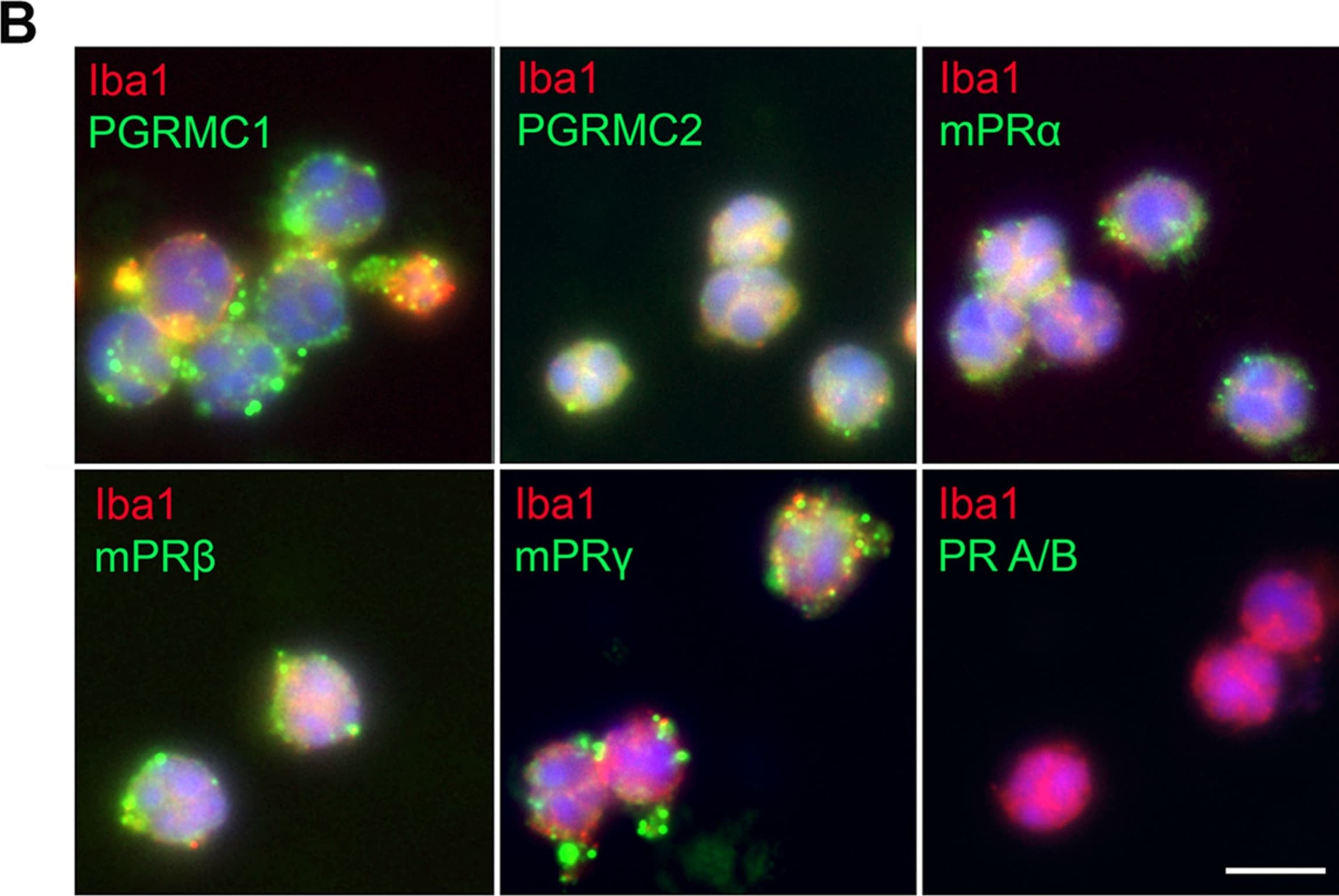 AIF-1/Iba1 Antibody
