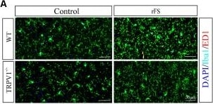 AIF-1/Iba1 Antibody