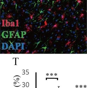 AIF-1/Iba1 Antibody