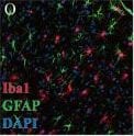 AIF-1/Iba1 Antibody