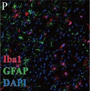 AIF-1/Iba1 Antibody
