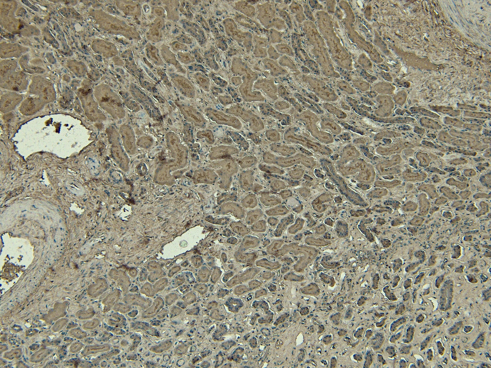 DAP3 Antibody
