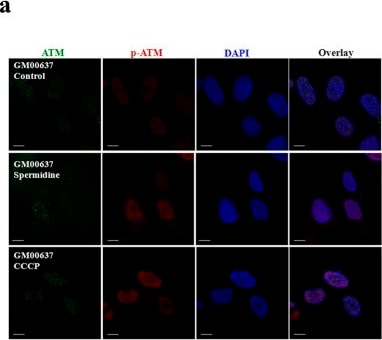 ATM Antibody