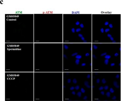 ATM Antibody