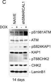 ATM Antibody