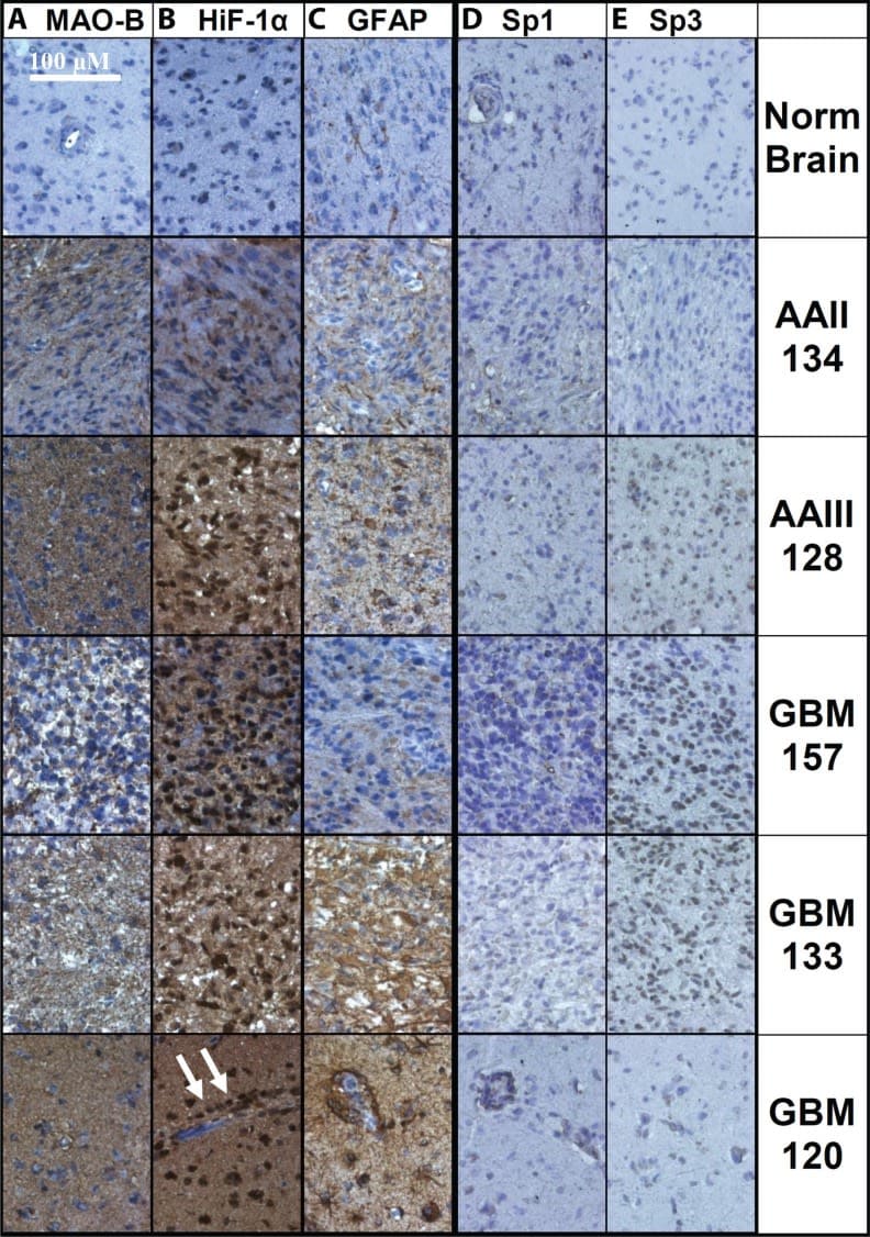 HIF-1 alpha Antibody (H1alpha67)