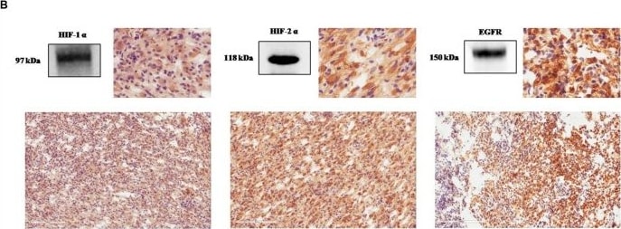 HIF-1 alpha Antibody (H1alpha67)