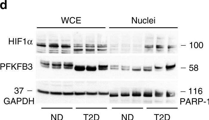 HIF-1 alpha Antibody (H1alpha67)
