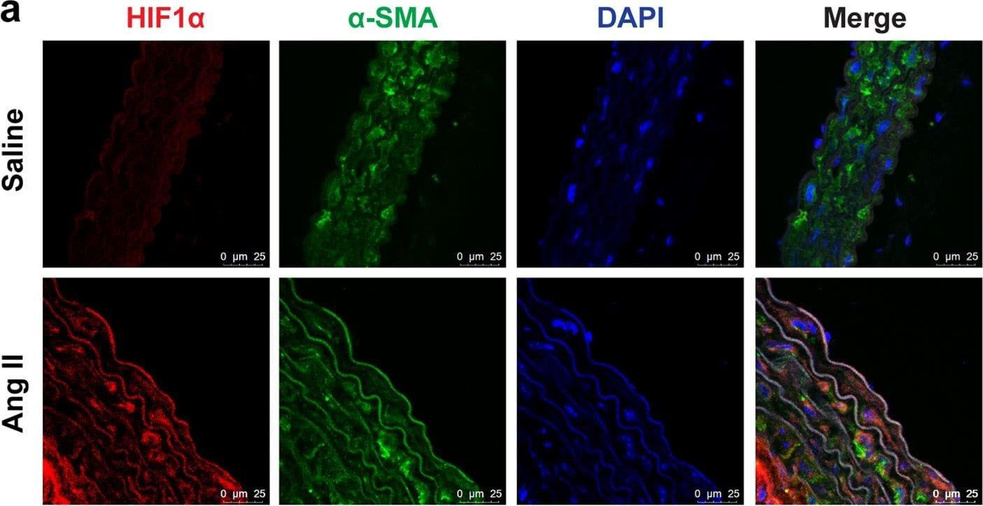 HIF-1 alpha Antibody (H1alpha67)