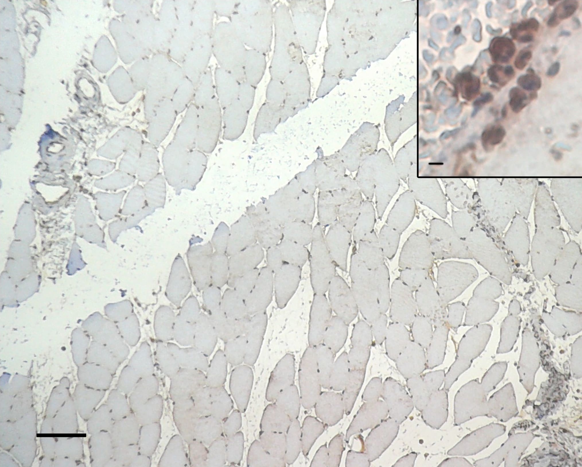 HIF-1 alpha Antibody (H1alpha67)