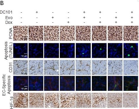 HIF-1 alpha Antibody (H1alpha67)