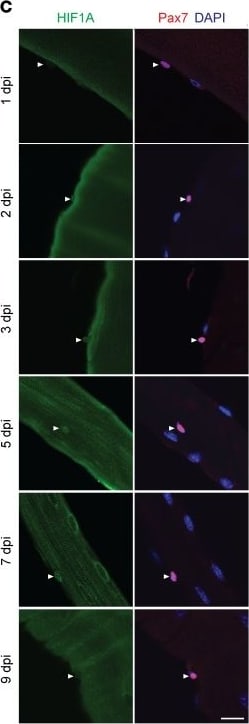 HIF-1 alpha Antibody (H1alpha67)