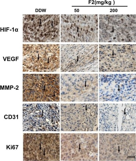 HIF-1 alpha Antibody (H1alpha67)