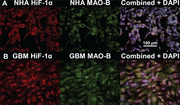 HIF-1 alpha Antibody (H1alpha67)