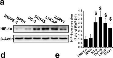 HIF-1 alpha Antibody (H1alpha67)