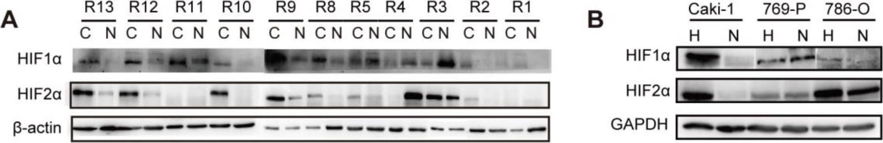 HIF-1 alpha Antibody (H1alpha67)