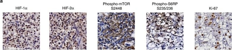 HIF-1 alpha Antibody (H1alpha67)