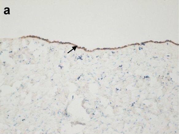 OGG1 Antibody - BSA Free