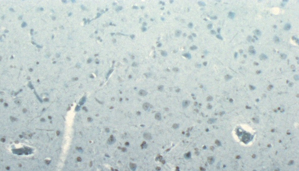 Dynactin Subunit 1/DCTN1 Antibody