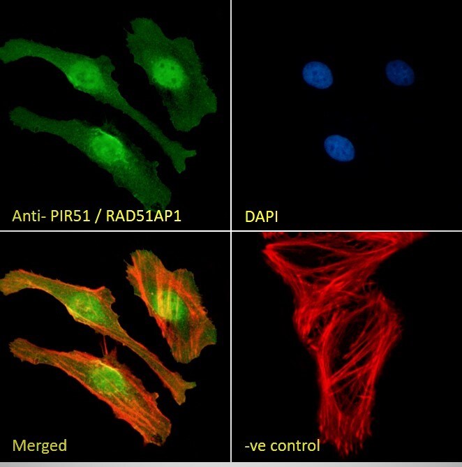 RAD51AP1 Antibody