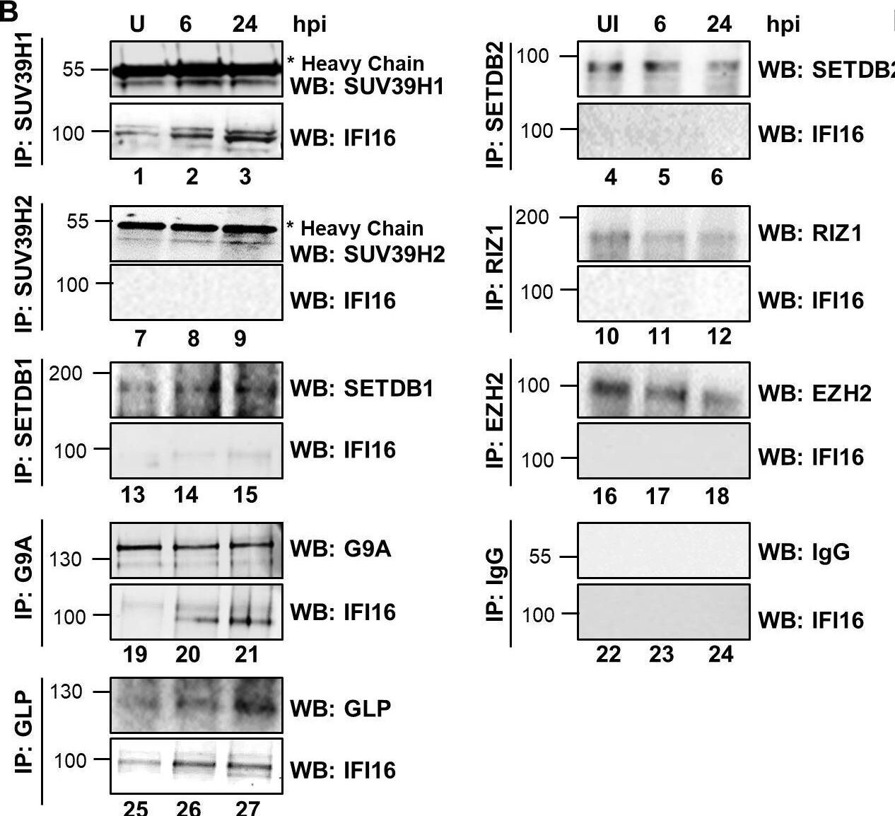 SETDB2 Antibody
