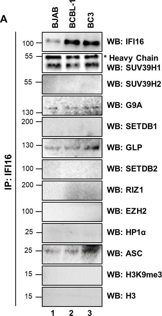 SETDB2 Antibody