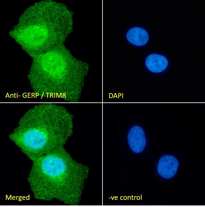 TRIM8 Antibody